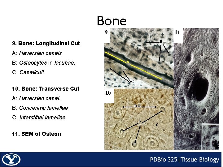 Bone 9 11 B 9. Bone: Longitudinal Cut A: Haversian canals B: Osteocytes in