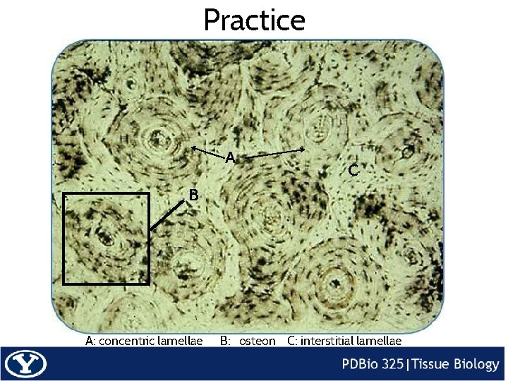 Practice A C B A: concentric lamellae B: osteon C: interstitial lamellae 