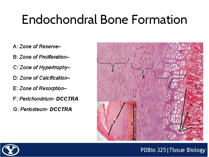 Endochondral Bone Formation A: Zone of Reserve– B: Zone of Proliferation– C: Zone of