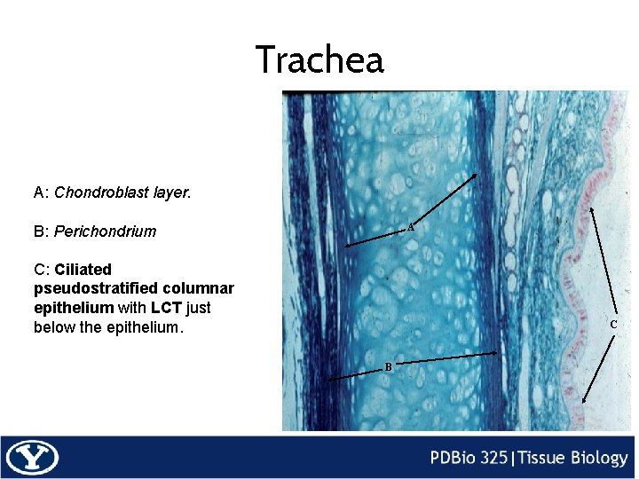 Trachea A: Chondroblast layer. A B: Perichondrium C: Ciliated pseudostratified columnar epithelium with LCT
