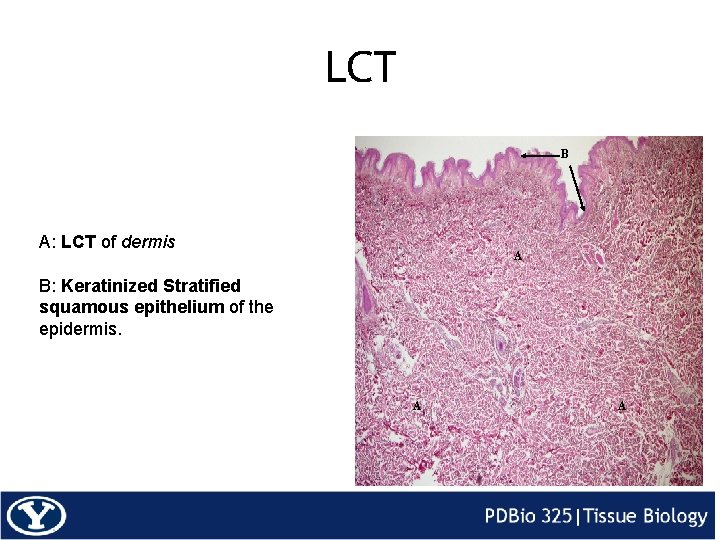 LCT B A: LCT of dermis A B: Keratinized Stratified squamous epithelium of the