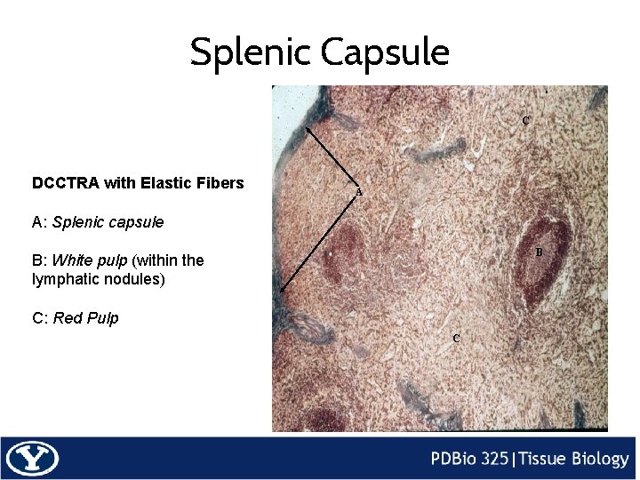 Splenic Capsule C DCCTRA with Elastic Fibers A A: Splenic capsule B B: White