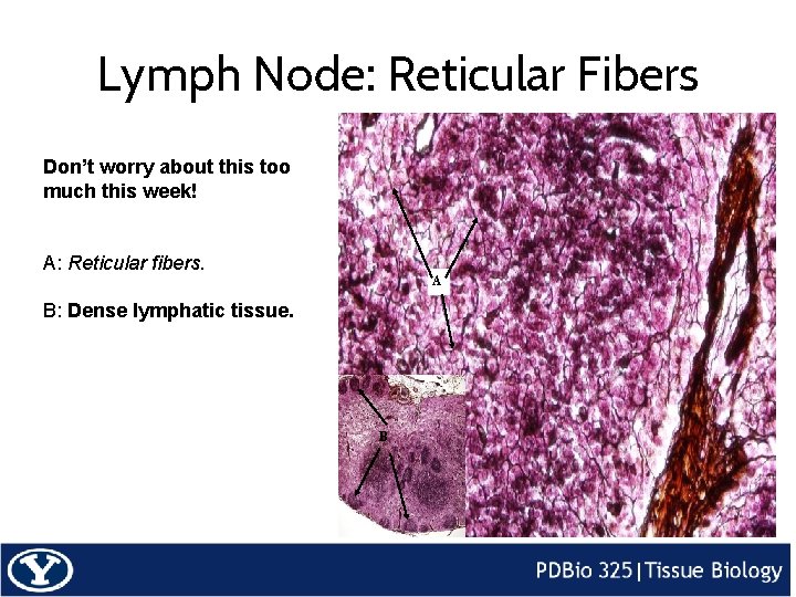 Lymph Node: Reticular Fibers Don’t worry about this too much this week! A: Reticular