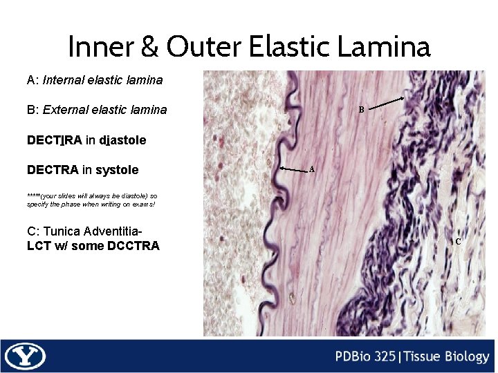 Inner & Outer Elastic Lamina A: Internal elastic lamina B: External elastic lamina B