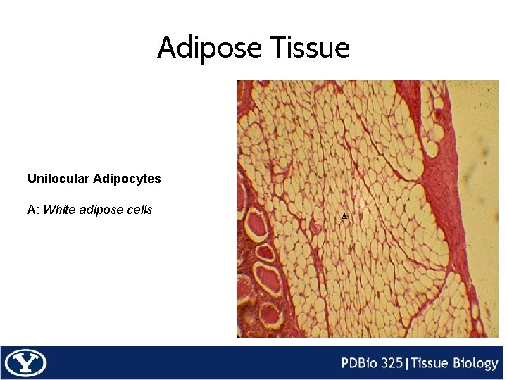 Adipose Tissue Unilocular Adipocytes A: White adipose cells A 