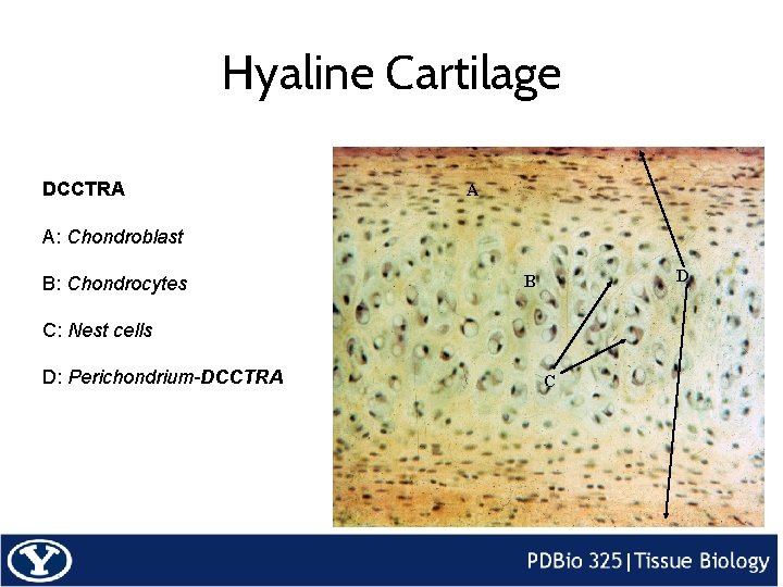 Hyaline Cartilage DCCTRA A A: Chondroblast B: Chondrocytes D B C: Nest cells D: