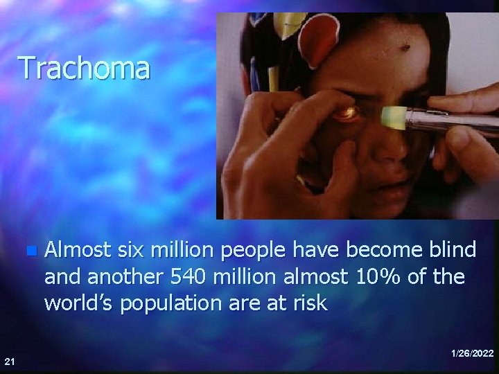 Trachoma n 21 Almost six million people have become blind another 540 million almost