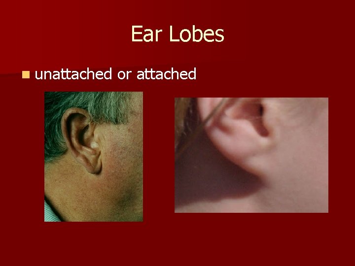 Ear Lobes n unattached or attached 