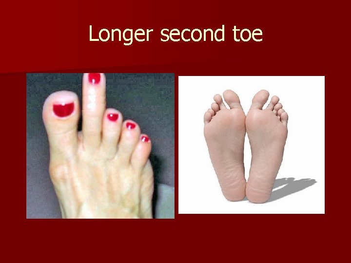 Longer second toe 