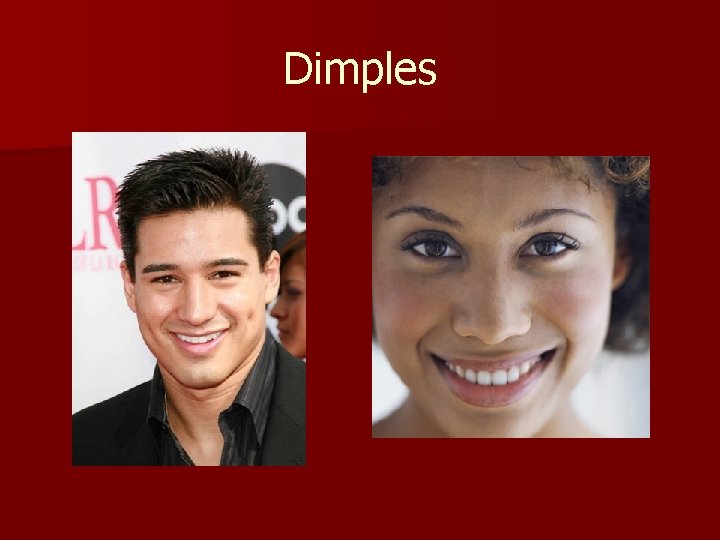 Dimples 