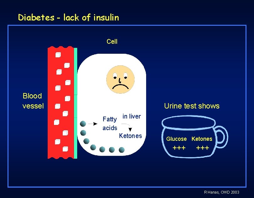 Diabetes - lack of insulin Cell Blood vessel Urine test shows Fatty in liver