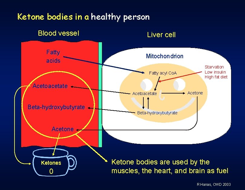 Ketone bodies in a healthy person Blood vessel Fatty acids Liver cell Mitochondrion Starvation