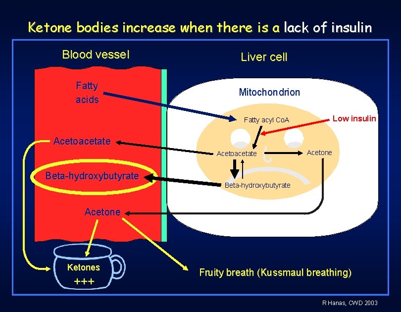 Ketone bodies increase when there is a lack of insulin Blood vessel Fatty acids