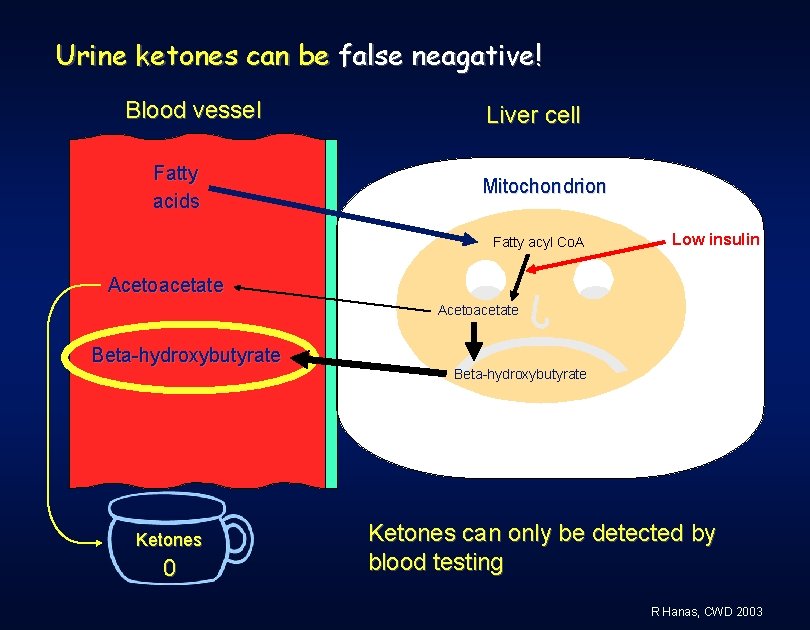 Urine ketones can be false neagative! Blood vessel Fatty acids Liver cell Mitochondrion Fatty