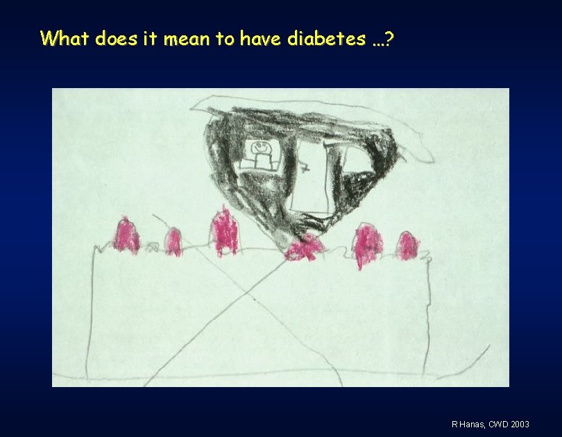 What does it mean to have diabetes …? R Hanas, CWD 2003 