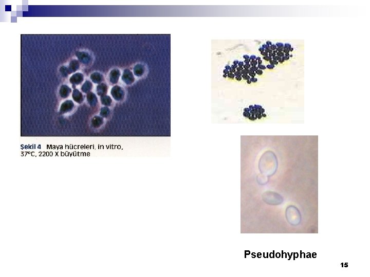 Pseudohyphae 15 
