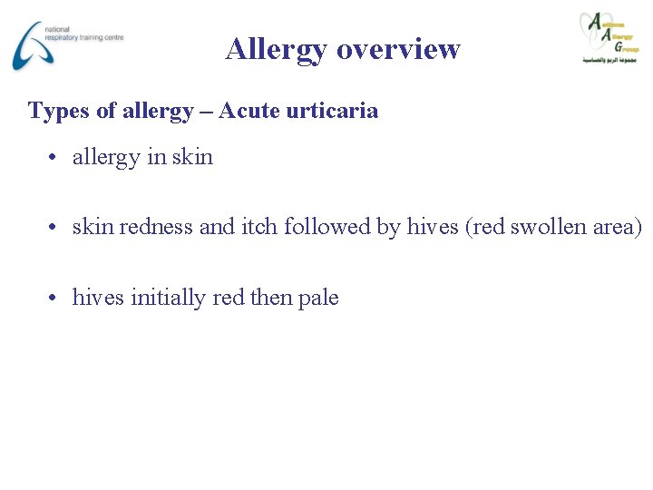 Allergy overview Types of allergy – Acute urticaria • allergy in skin • skin