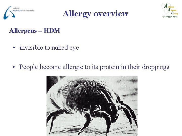 Allergy overview Allergens – HDM • invisible to naked eye • People become allergic