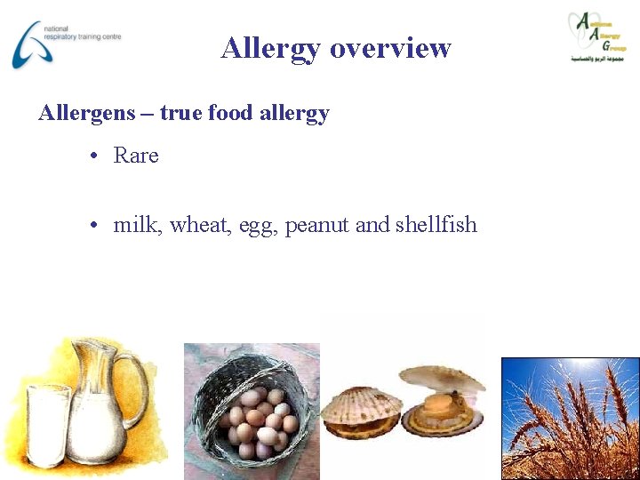 Allergy overview Allergens – true food allergy • Rare • milk, wheat, egg, peanut