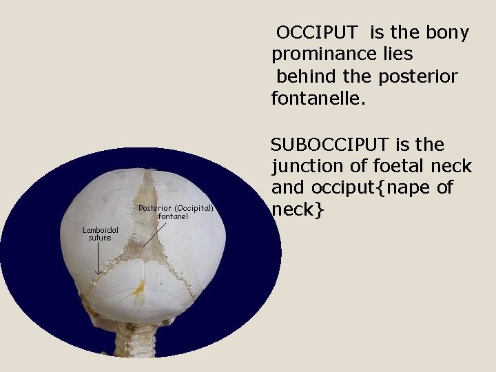 OCCIPUT is the bony prominance lies behind the posterior fontanelle. SUBOCCIPUT is the junction