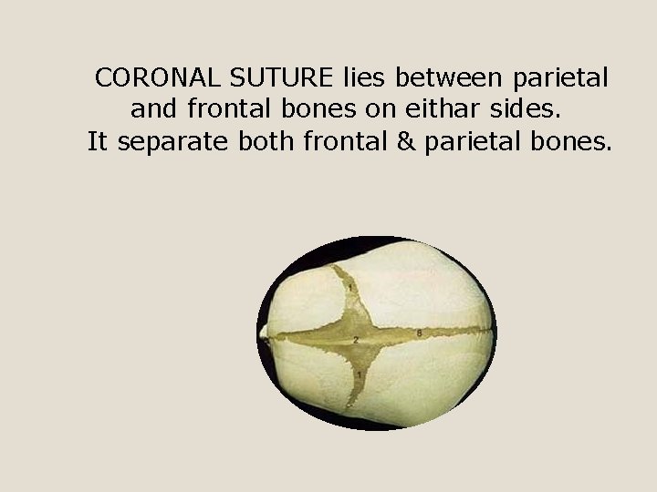 CORONAL SUTURE lies between parietal and frontal bones on eithar sides. It separate both