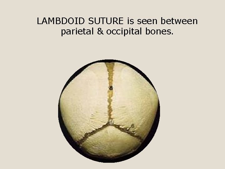 LAMBDOID SUTURE is seen between parietal & occipital bones. 