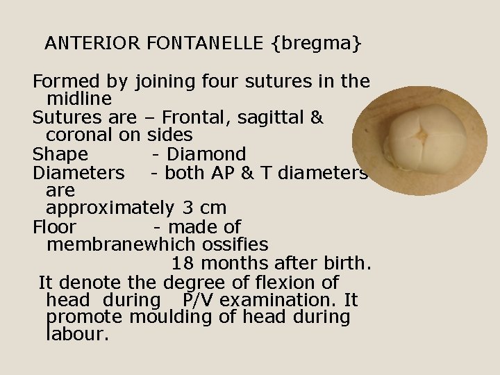 ANTERIOR FONTANELLE {bregma} Formed by joining four sutures in the midline Sutures are –