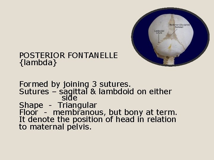 POSTERIOR FONTANELLE {lambda} Formed by joining 3 sutures. Sutures – sagittal & lambdoid on