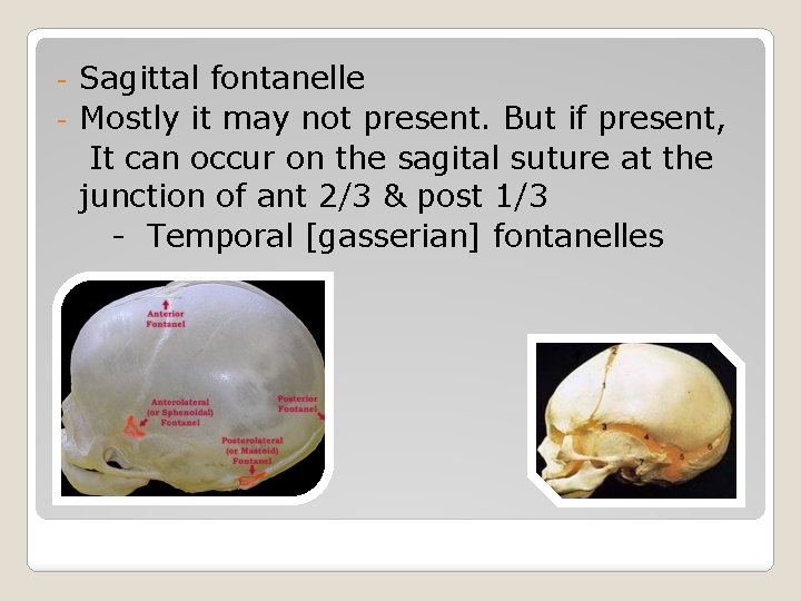 Sagittal fontanelle - Mostly it may not present. But if present, It can occur