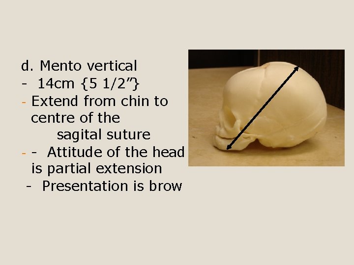 d. Mento vertical - 14 cm {5 1/2”} - Extend from chin to centre