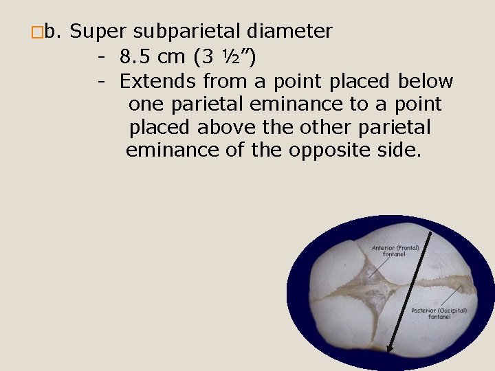 �b. Super subparietal diameter - 8. 5 cm (3 ½”) - Extends from a