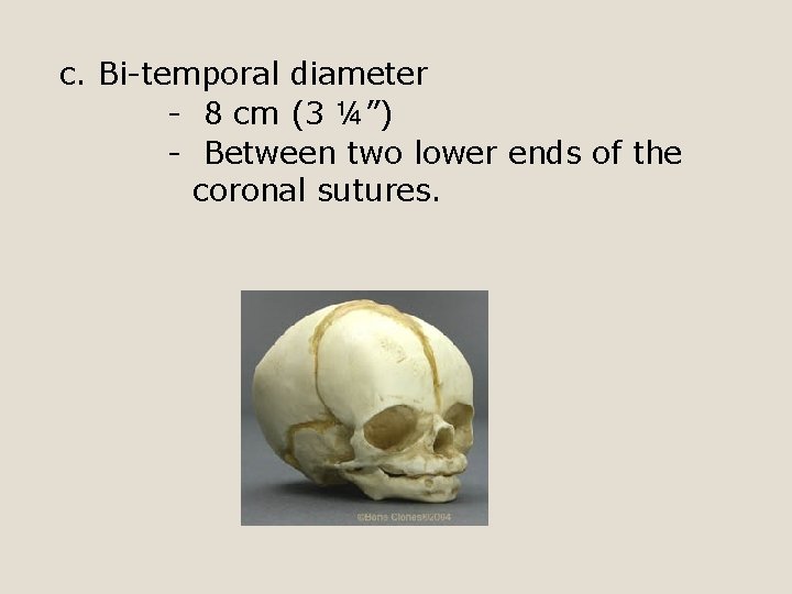 c. Bi-temporal diameter - 8 cm (3 ¼”) - Between two lower ends of
