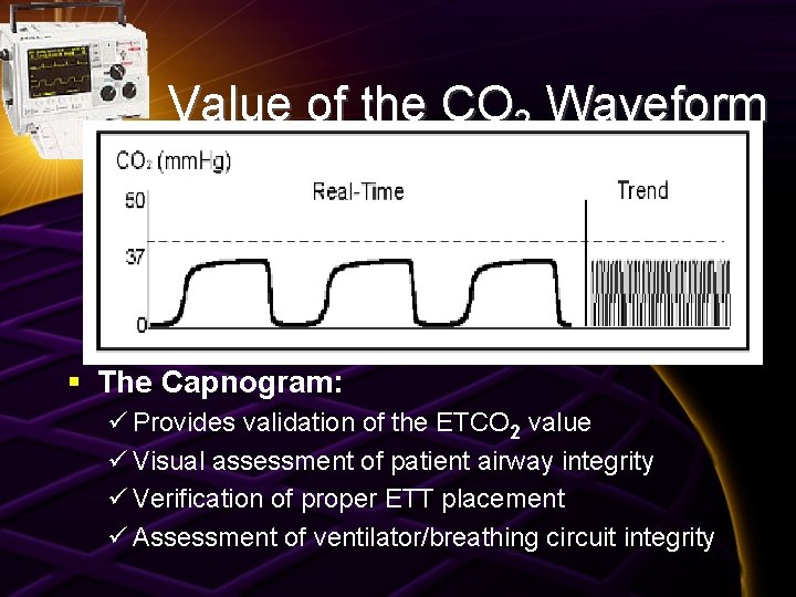 Value of the CO 2 Waveform § The Capnogram: ü Provides validation of the