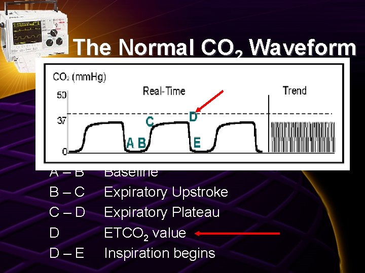 The Normal CO 2 Waveform A–B B–C C–D D D–E Baseline Expiratory Upstroke Expiratory