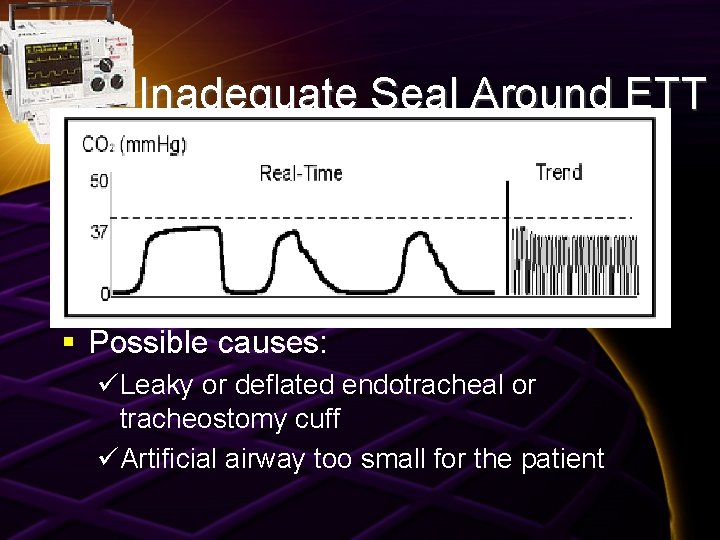 Inadequate Seal Around ETT § Possible causes: üLeaky or deflated endotracheal or tracheostomy cuff
