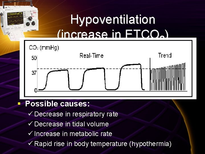 Hypoventilation (increase in ETCO 2) § Possible causes: ü Decrease in respiratory rate ü