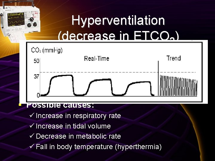Hyperventilation (decrease in ETCO 2) § Possible causes: ü Increase in respiratory rate ü
