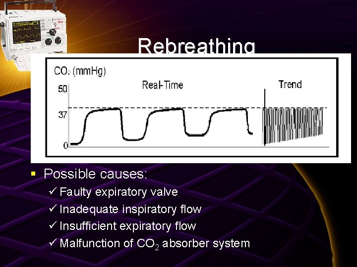 Rebreathing § Possible causes: ü Faulty expiratory valve ü Inadequate inspiratory flow ü Insufficient