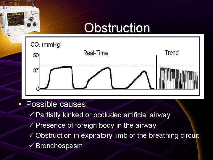Obstruction § Possible causes: ü Partially kinked or occluded artificial airway ü Presence of