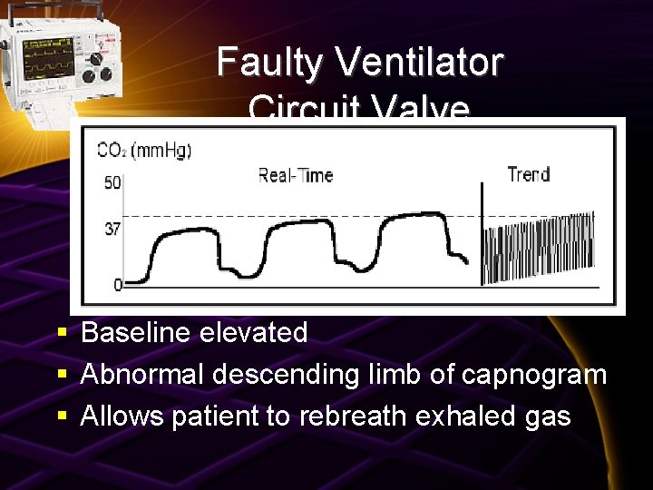 Faulty Ventilator Circuit Valve § Baseline elevated § Abnormal descending limb of capnogram §