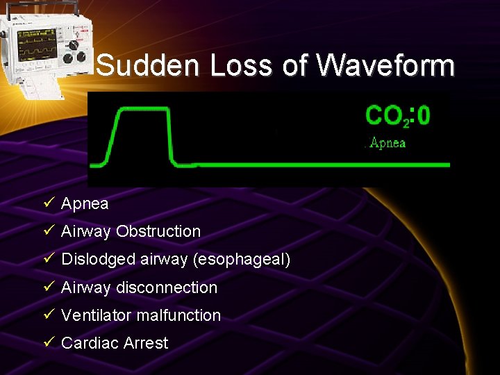 Sudden Loss of Waveform ü Apnea ü Airway Obstruction ü Dislodged airway (esophageal) ü
