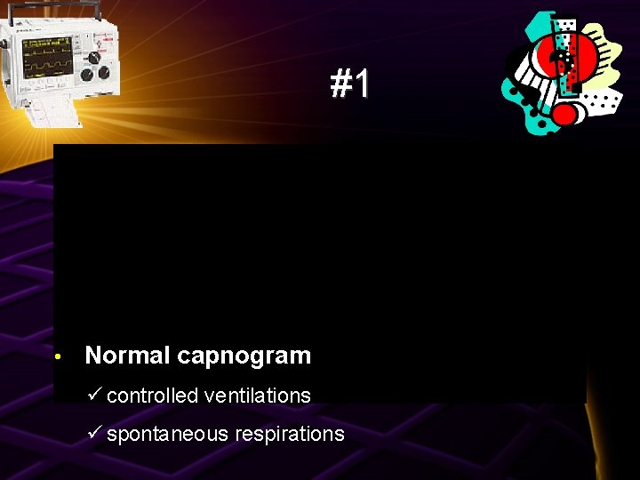 #1 • Normal capnogram ü controlled ventilations ü spontaneous respirations 