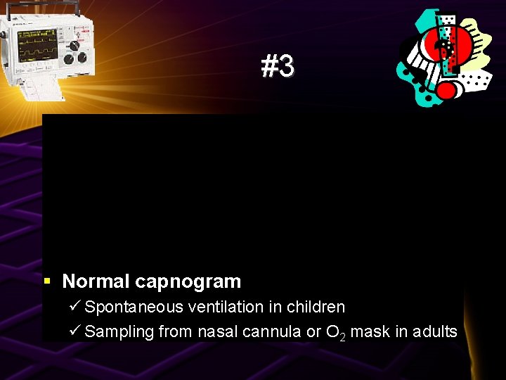 #3 § Normal capnogram ü Spontaneous ventilation in children ü Sampling from nasal cannula