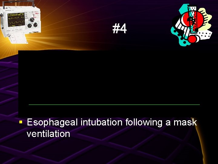 #4 § Esophageal intubation following a mask ventilation 