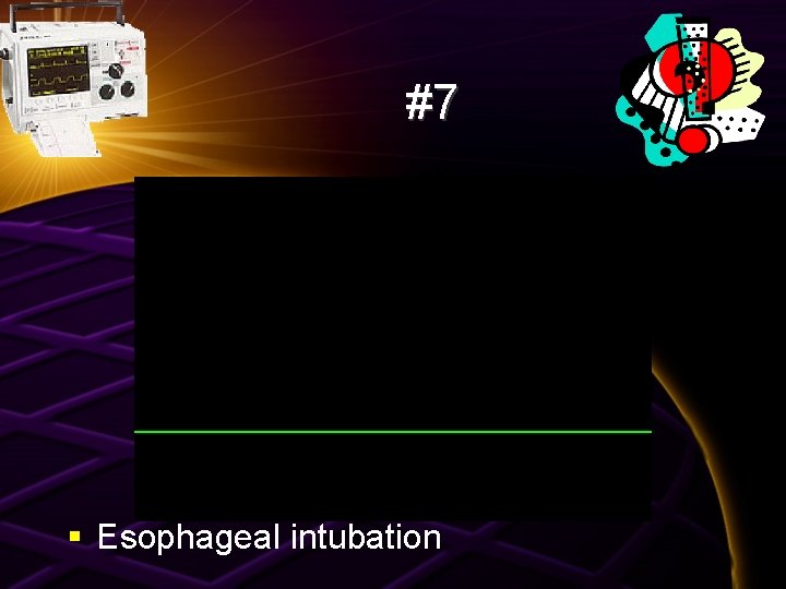 #7 § Esophageal intubation 