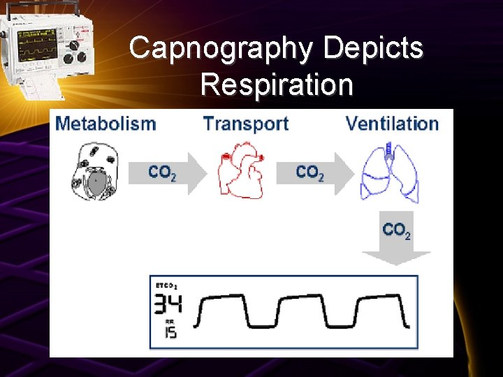 Capnography Depicts Respiration 