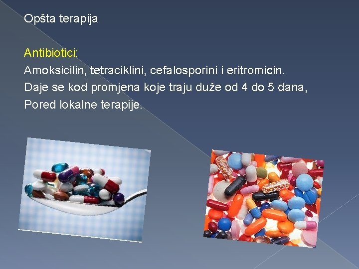 Opšta terapija Antibiotici: Amoksicilin, tetraciklini, cefalosporini i eritromicin. Daje se kod promjena koje traju