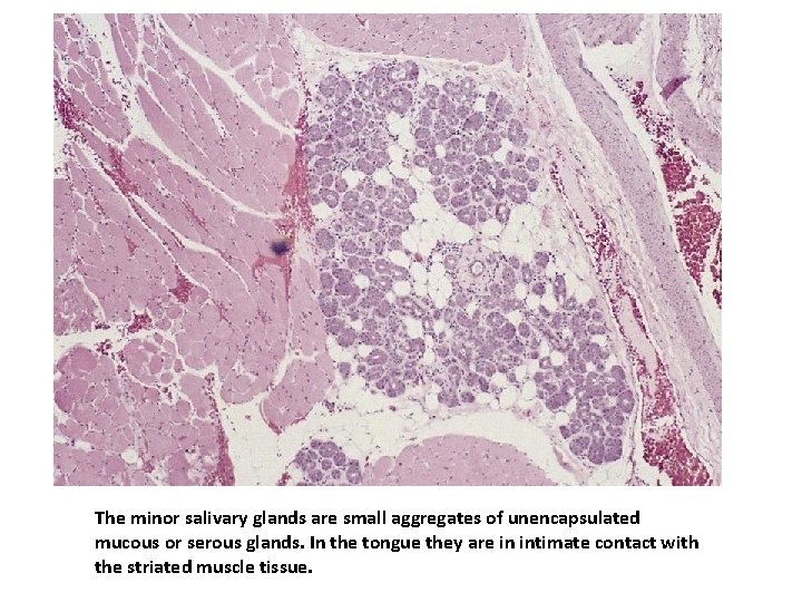 The minor salivary glands are small aggregates of unencapsulated mucous or serous glands. In