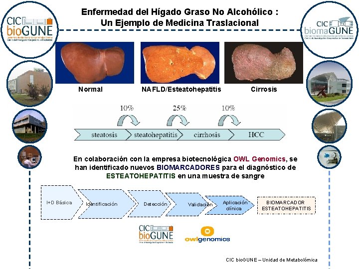 Enfermedad del Hígado Graso No Alcohólico : Un Ejemplo de Medicina Traslacional Normal NAFLD/Esteatohepatitis