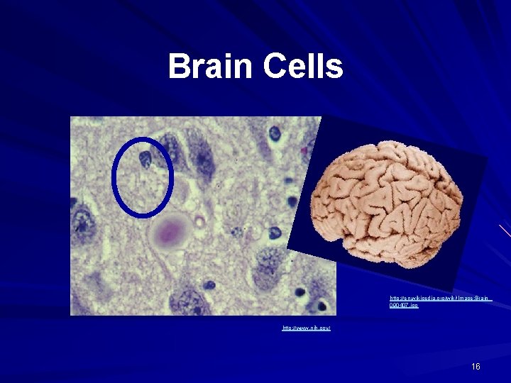 Brain Cells http: //en. wikipedia. org/wiki/Image: Brain_ 090407. jpg http: //www. nih. gov/ 16